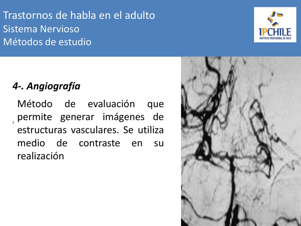 Trastornos de habla en el adulto Sistema Nervioso Métodos de estudio