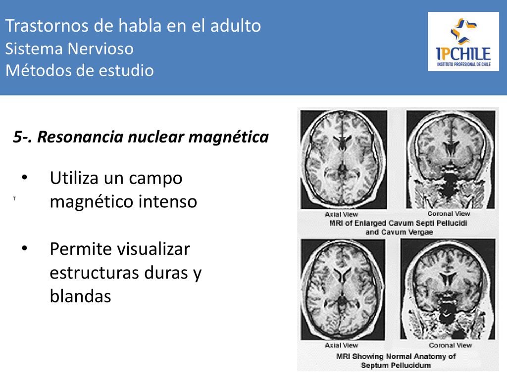 Trastornos de habla en el adulto Sistema Nervioso Métodos de estudio
