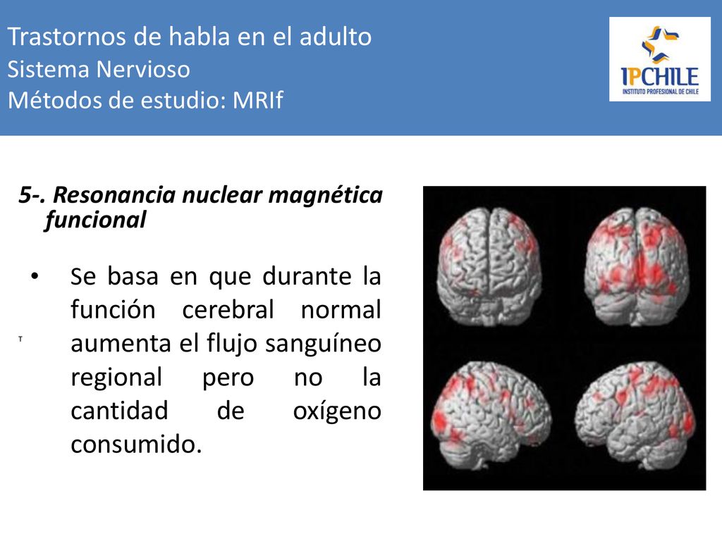 Trastornos de habla en el adulto Sistema Nervioso Métodos de estudio: MRIf