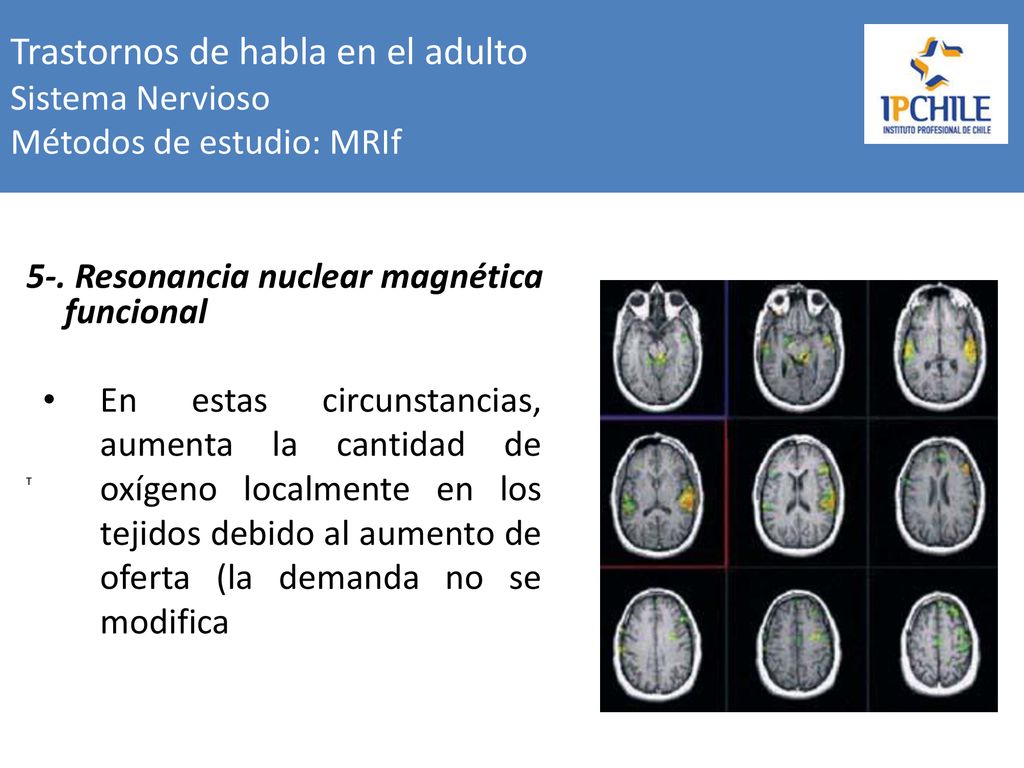 Trastornos de habla en el adulto Sistema Nervioso Métodos de estudio: MRIf
