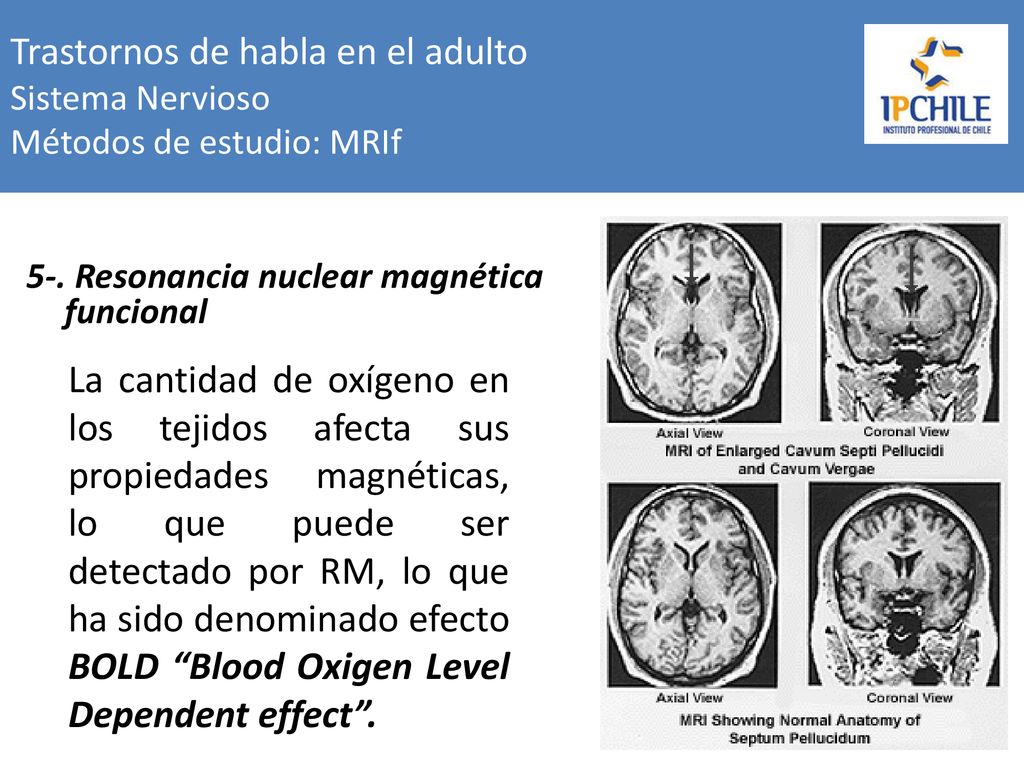 Trastornos de habla en el adulto Sistema Nervioso Métodos de estudio: MRIf