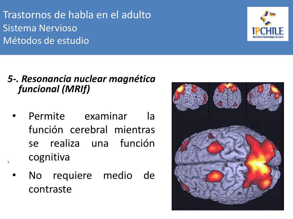 Trastornos de habla en el adulto Sistema Nervioso Métodos de estudio