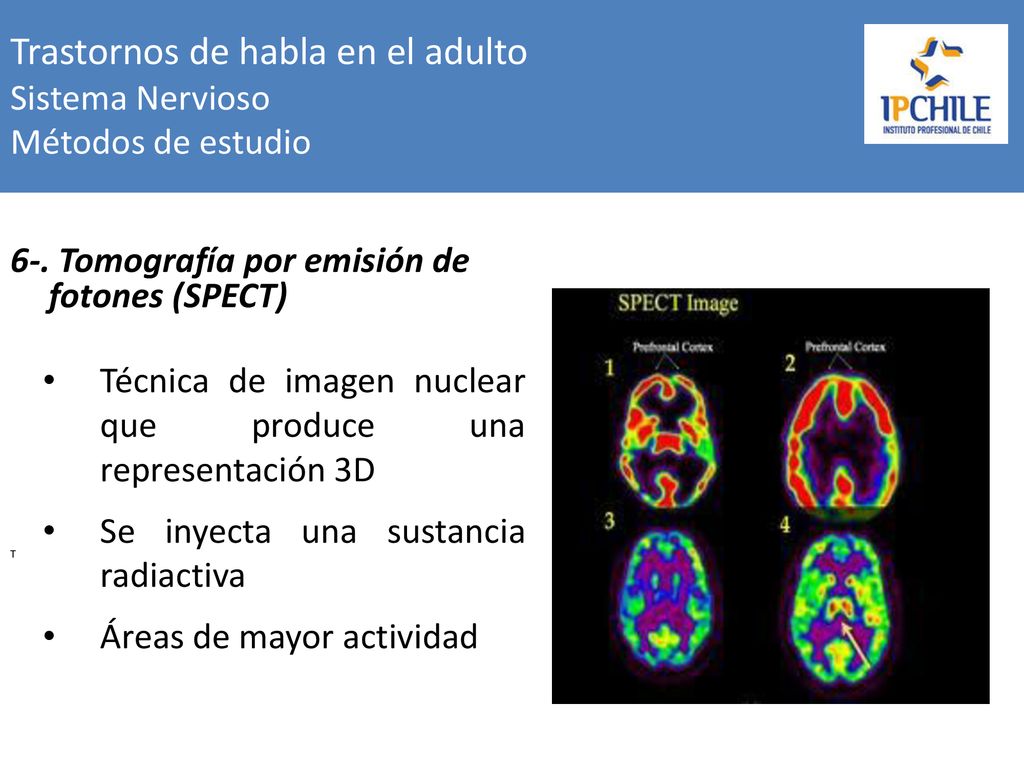 Trastornos de habla en el adulto Sistema Nervioso Métodos de estudio