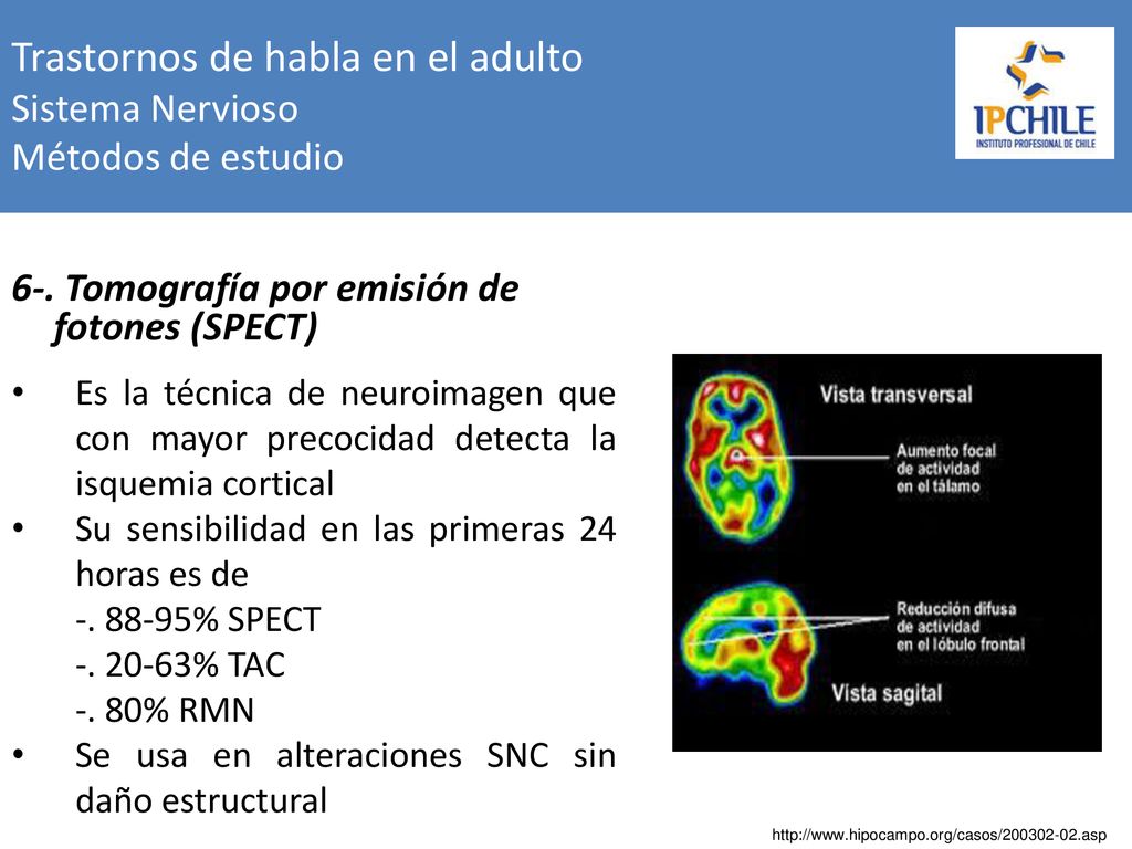 Trastornos de habla en el adulto Sistema Nervioso Métodos de estudio
