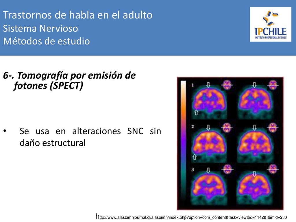 Trastornos de habla en el adulto Sistema Nervioso Métodos de estudio