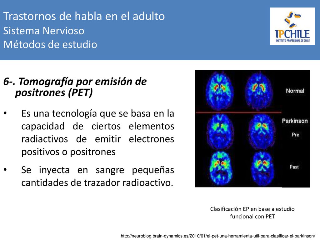 Trastornos de habla en el adulto Sistema Nervioso Métodos de estudio
