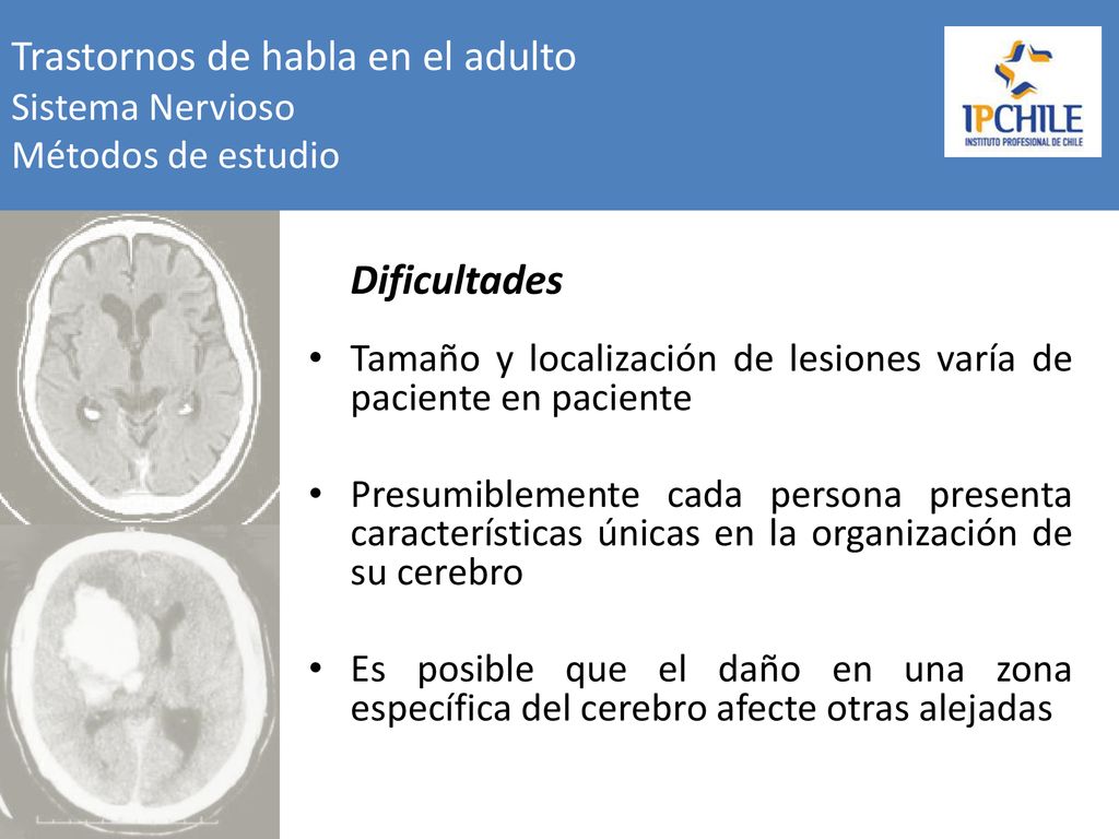 Trastornos de habla en el adulto Sistema Nervioso Métodos de estudio