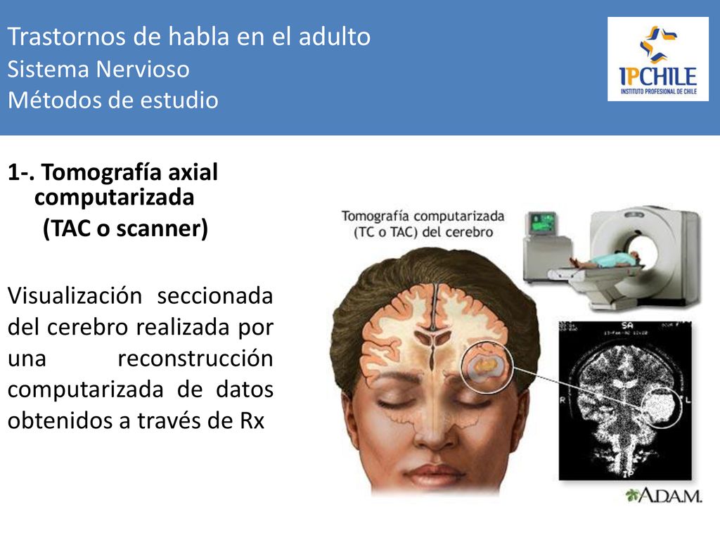 Trastornos de habla en el adulto Sistema Nervioso Métodos de estudio