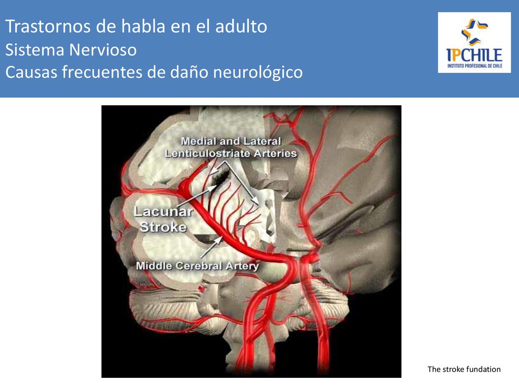 Trastornos de habla en el adulto Sistema Nervioso Causas frecuentes de daño neurológico