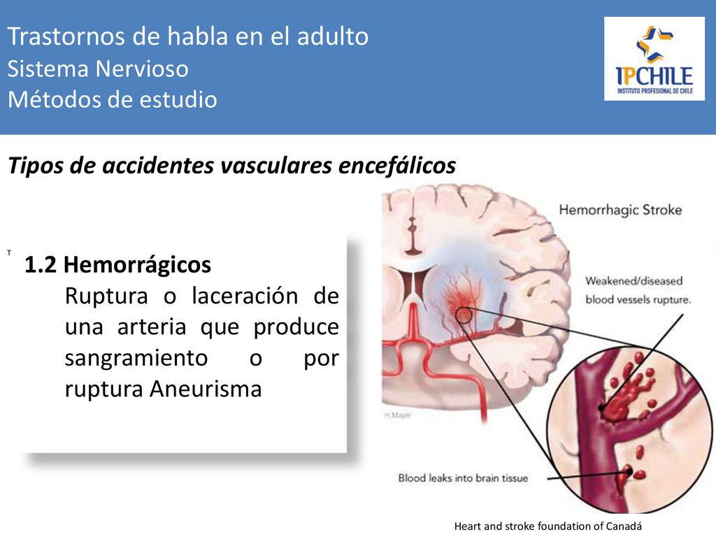 Trastornos de habla en el adulto Sistema Nervioso Métodos de estudio