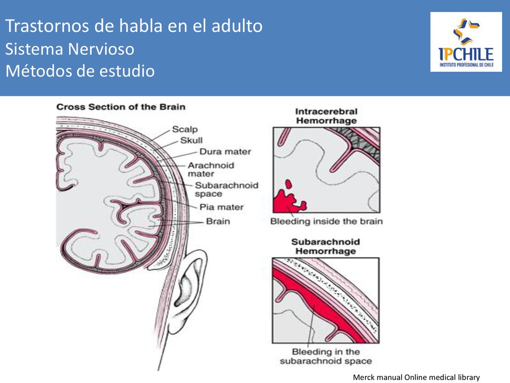 Trastornos de habla en el adulto Sistema Nervioso Métodos de estudio