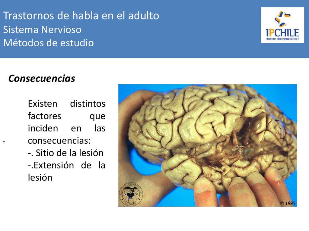 Trastornos de habla en el adulto Sistema Nervioso Métodos de estudio