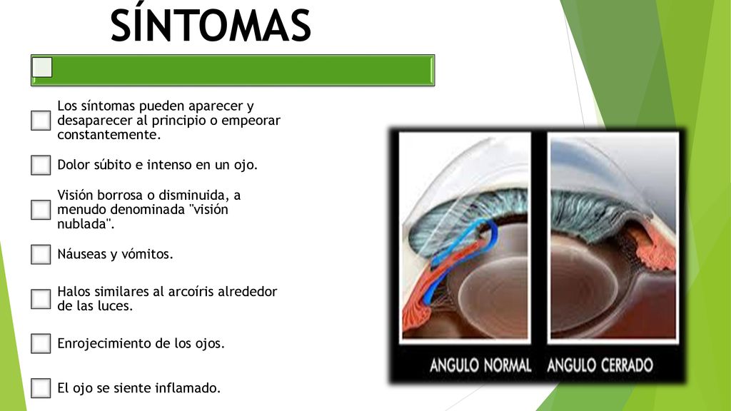 SÍNTOMAS Los síntomas pueden aparecer y desaparecer al principio o empeorar constantemente. Dolor súbito e intenso en un ojo.