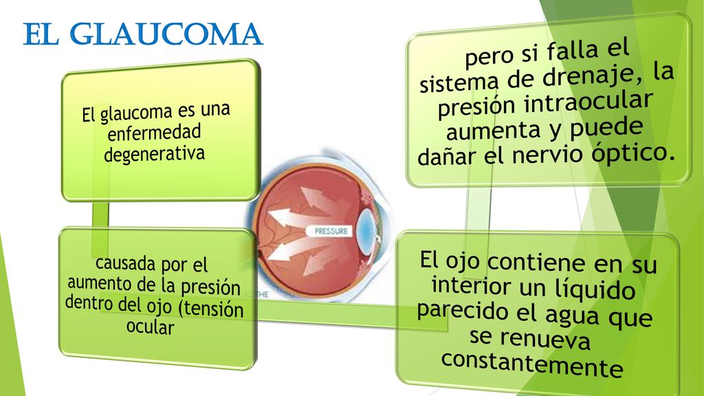El glaucoma El glaucoma es una enfermedad degenerativa. causada por el aumento de la presión dentro del ojo (tensión ocular.