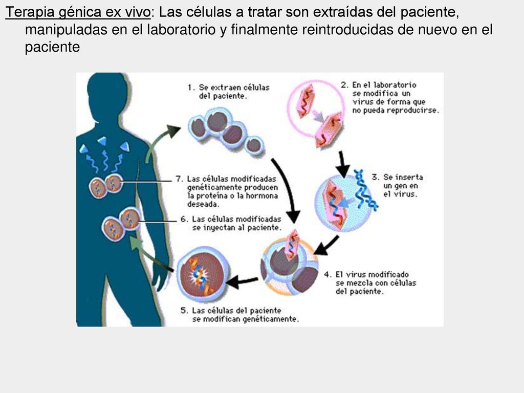 Terapia génica ex vivo: Las células a tratar son extraídas del paciente, manipuladas en el laboratorio y finalmente reintroducidas de nuevo en el paciente