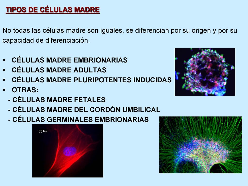 TIPOS DE CÉLULAS MADRE No todas las células madre son iguales, se diferencian por su origen y por su.
