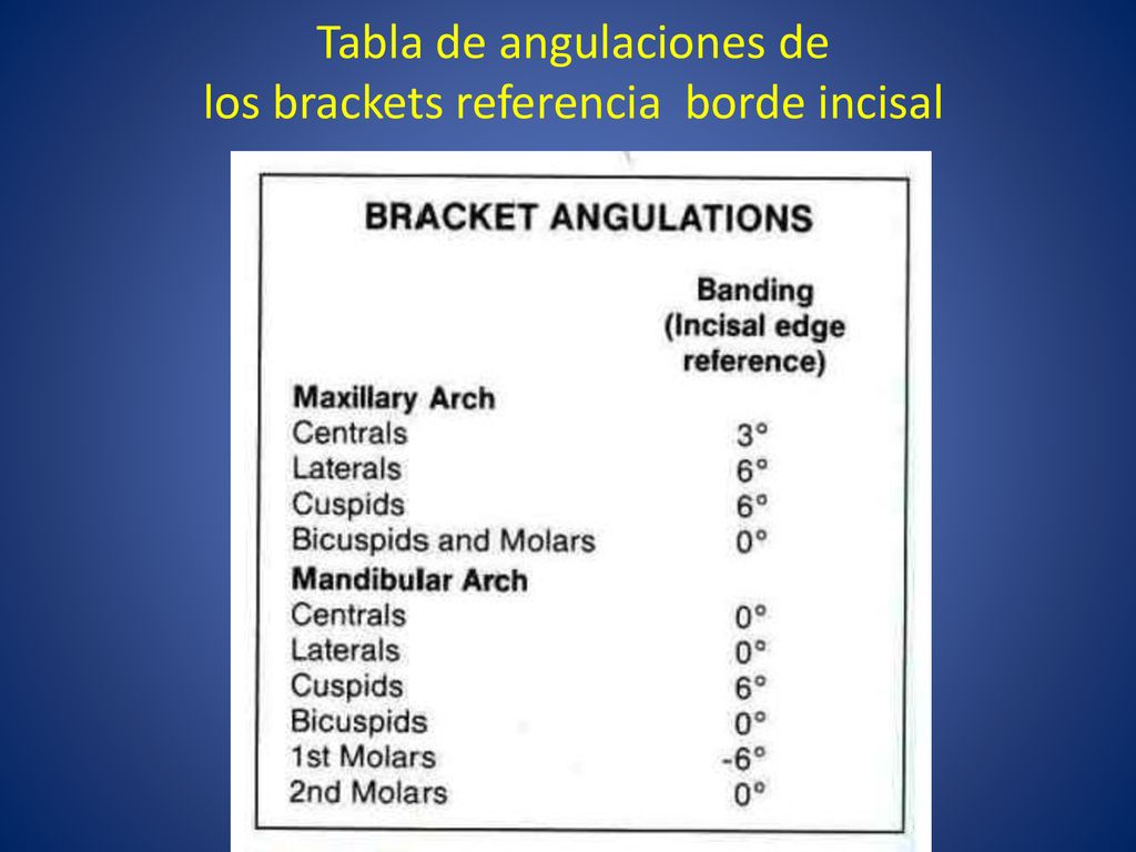 Tabla de angulaciones de los brackets referencia borde incisal