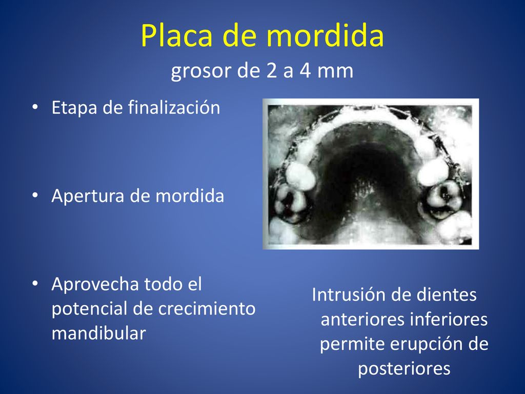Placa de mordida grosor de 2 a 4 mm