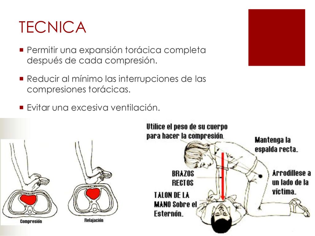 TECNICA Permitir una expansión torácica completa después de cada compresión. Reducir al mínimo las interrupciones de las compresiones torácicas.