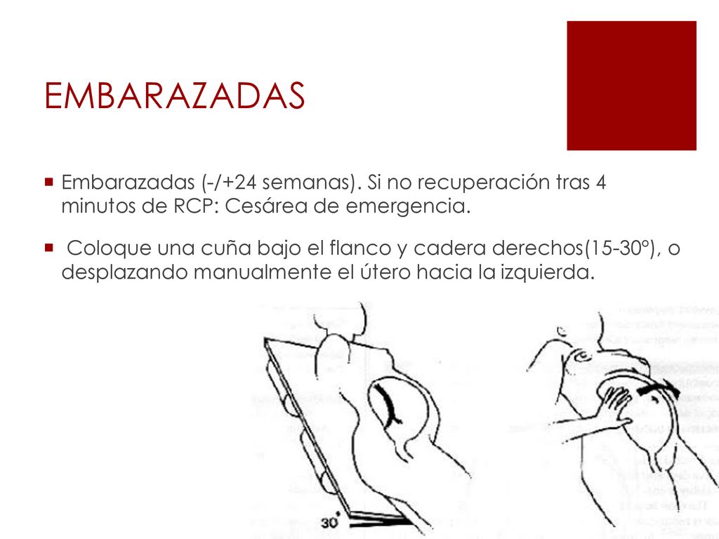 EMBARAZADAS Embarazadas (-/+24 semanas). Si no recuperación tras 4 minutos de RCP: Cesárea de emergencia.