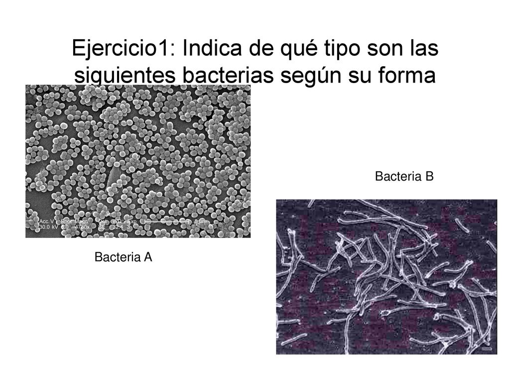 Ejercicio1: Indica de qué tipo son las siguientes bacterias según su forma