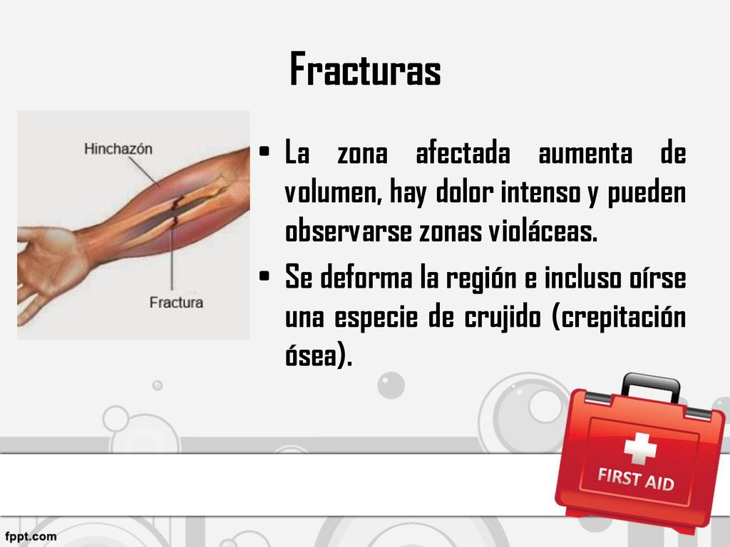 Fracturas La zona afectada aumenta de volumen, hay dolor intenso y pueden observarse zonas violáceas.