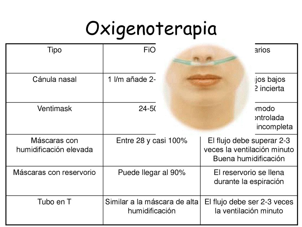 Oxigenoterapia Tipo FiO2 Comentarios Cánula nasal