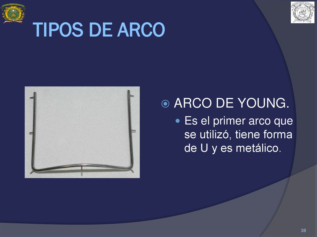 TIPOS DE ARCO ARCO DE YOUNG.