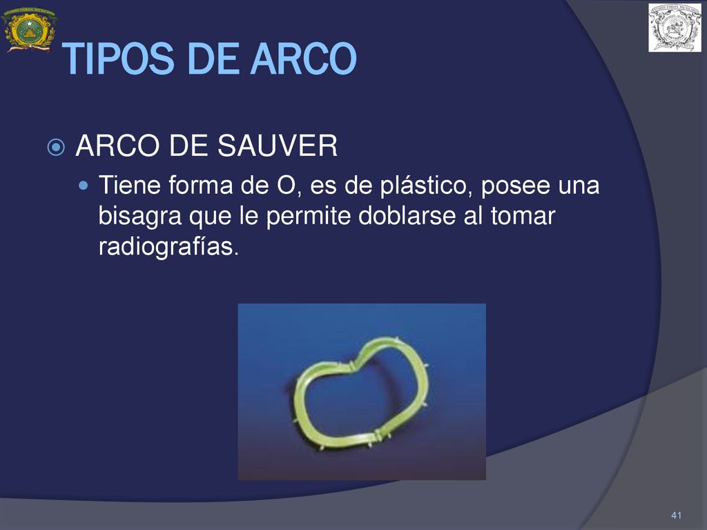TIPOS DE ARCO ARCO DE SAUVER