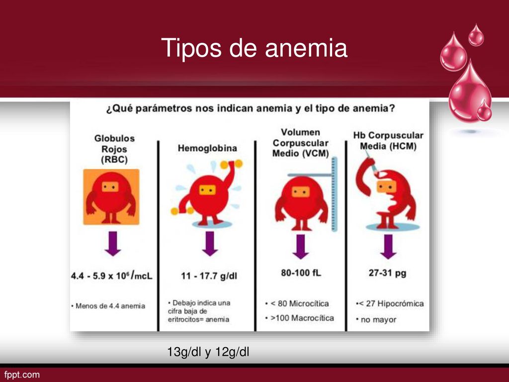 Tipos de anemia 13g/dl y 12g/dl