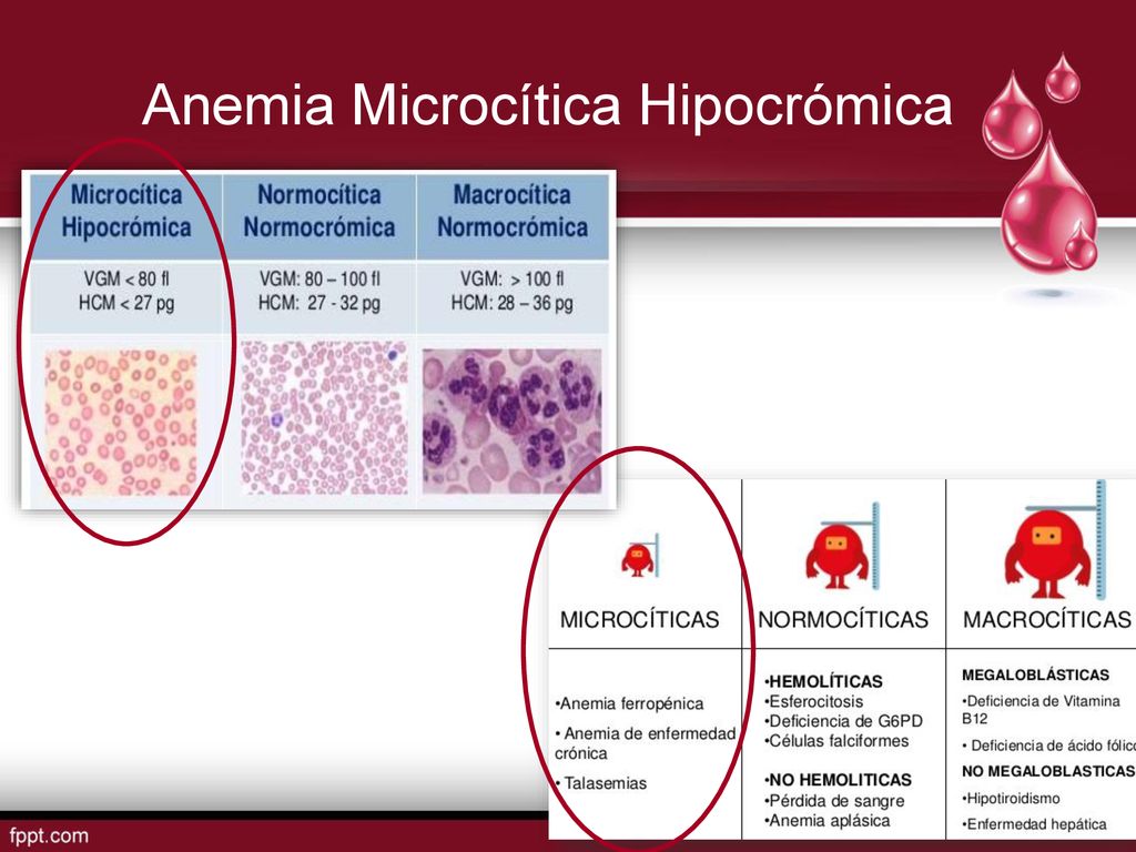 Anemias INSTITUTO MEXICANO DEL SEGURO SOCIAL - ppt descargar