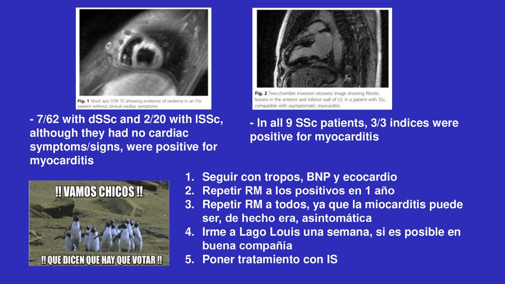 - 7/62 with dSSc and 2/20 with lSSc, although they had no cardiac symptoms/signs, were positive for myocarditis
