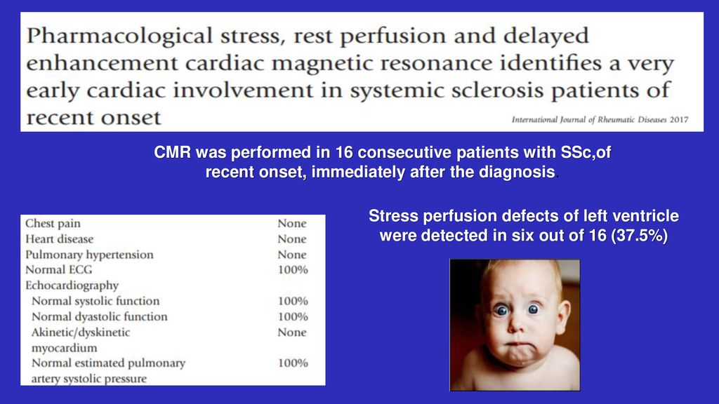 CMR was performed in 16 consecutive patients with SSc,of recent onset, immediately after the diagnosis.