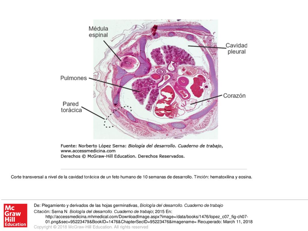 Corte transversal a nivel de la cavidad torácica de un feto humano de 10 semanas de desarrollo. Tinción: hematoxilina y eosina.