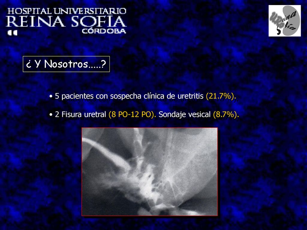 ¿ Y Nosotros pacientes con sospecha clínica de uretritis (21.7%).