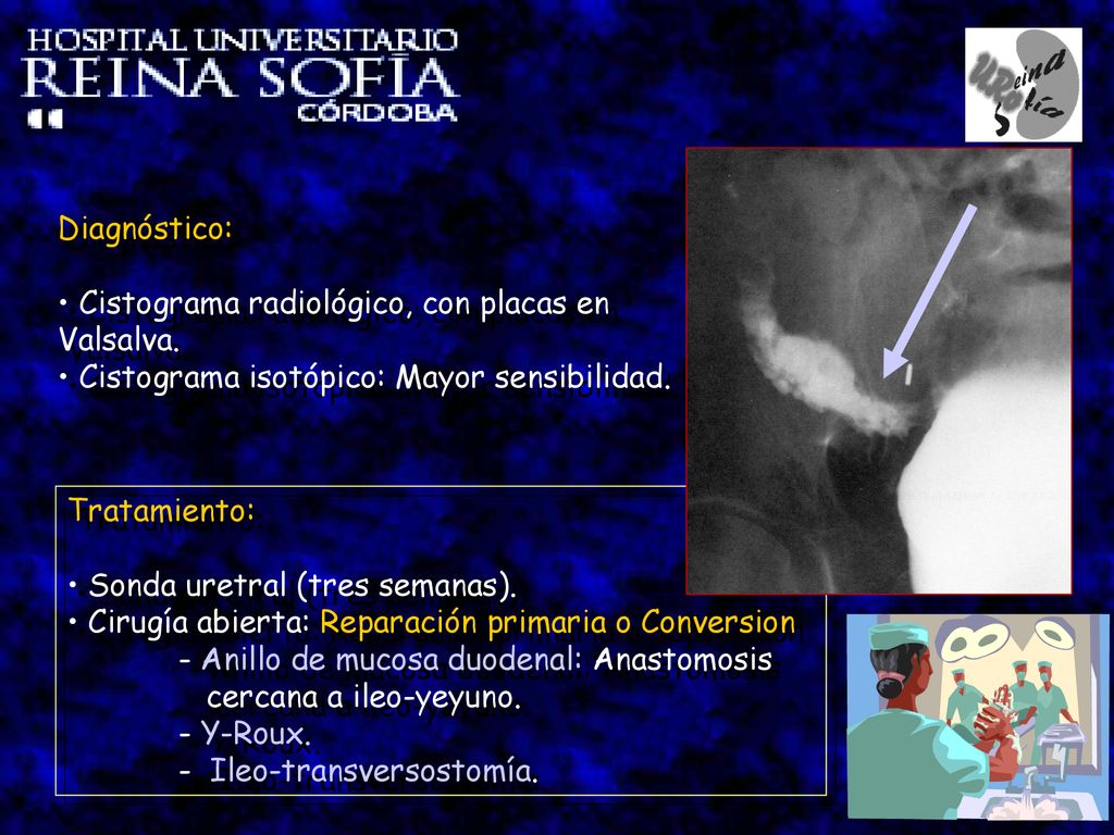 Diagnóstico: Cistograma radiológico, con placas en Valsalva. Cistograma isotópico: Mayor sensibilidad.