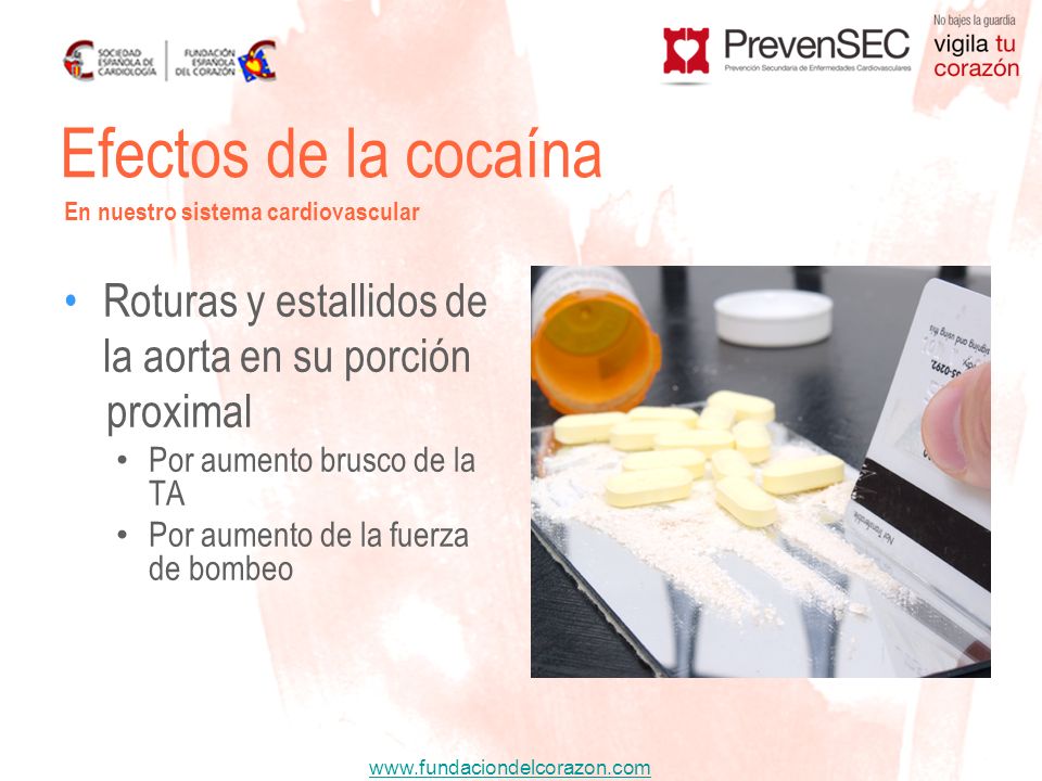 Efectos de la cocaína Roturas y estallidos de la aorta en su porción