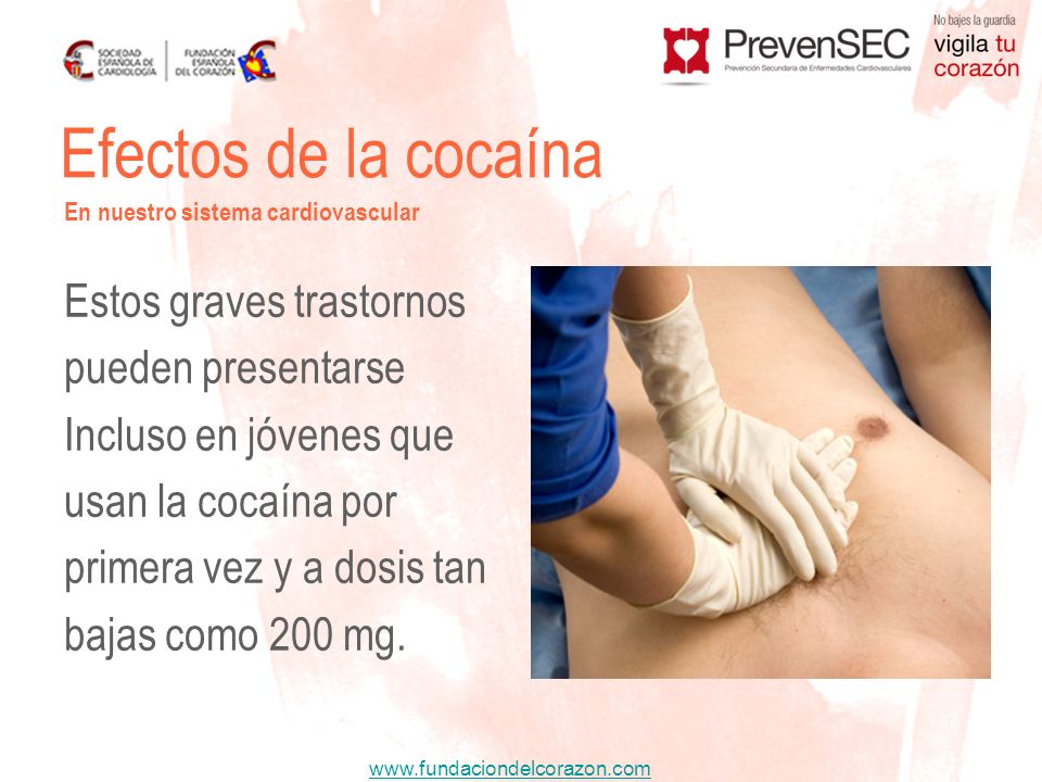 Efectos de la cocaína Estos graves trastornos pueden presentarse