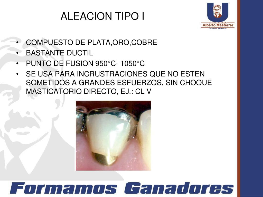 ALEACION TIPO I COMPUESTO DE PLATA,ORO,COBRE BASTANTE DUCTIL