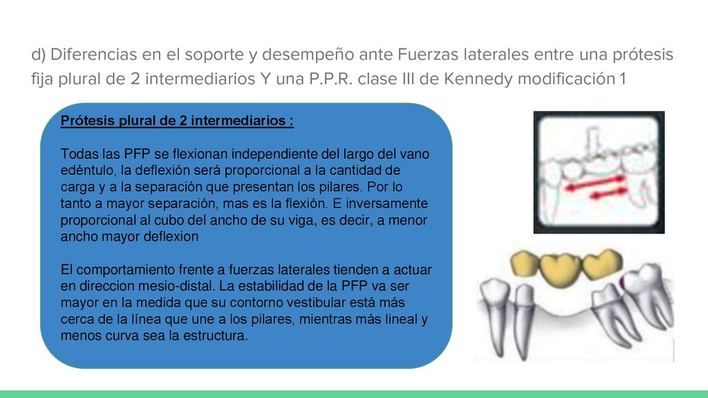 d) Diferencias en el soporte y desempeño ante Fuerzas laterales entre una prótesis fija plural de 2 intermediarios Y una P.P.R. clase III de Kennedy modificación 1