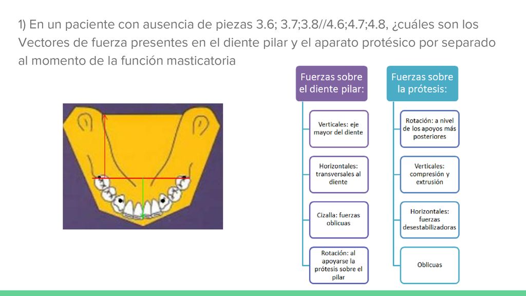 1) En un paciente con ausencia de piezas 3. 6; 3. 7;3. 8//4. 6;4. 7;4