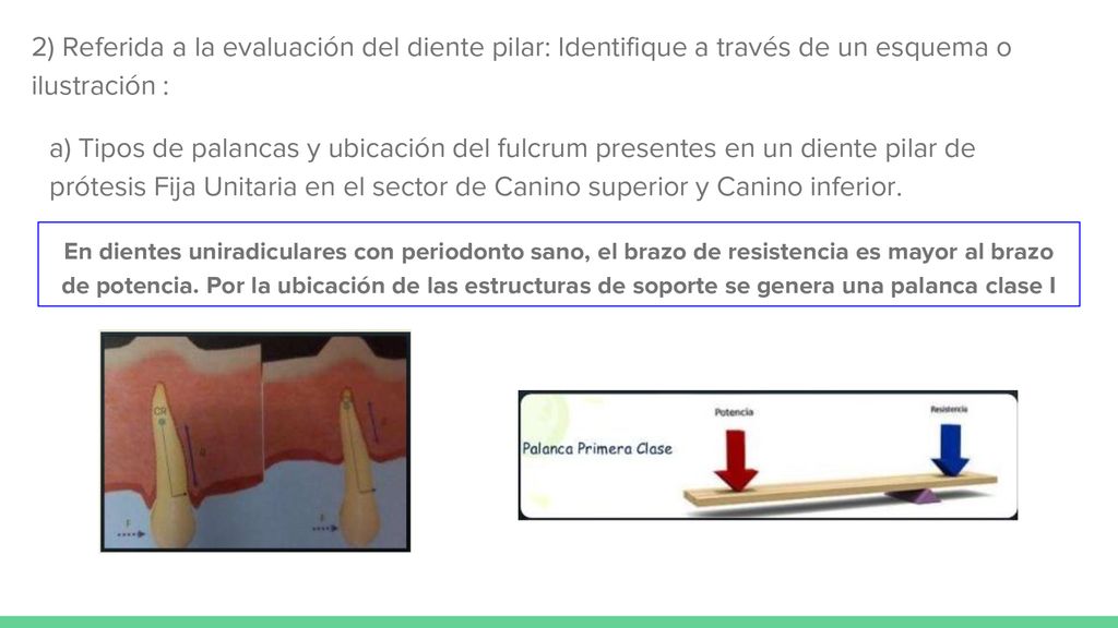 2) Referida a la evaluación del diente pilar: Identifique a través de un esquema o ilustración :