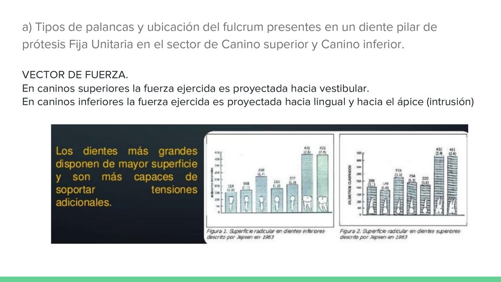 a) Tipos de palancas y ubicación del fulcrum presentes en un diente pilar de prótesis Fija Unitaria en el sector de Canino superior y Canino inferior.