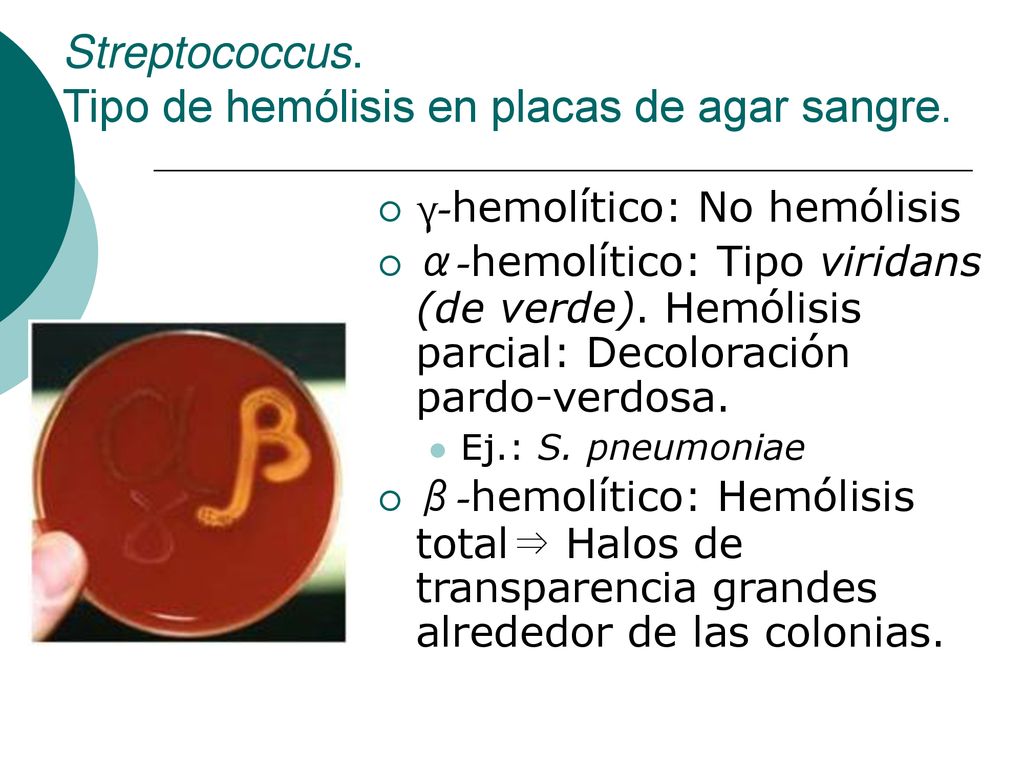 Streptococcus. Tipo de hemólisis en placas de agar sangre.