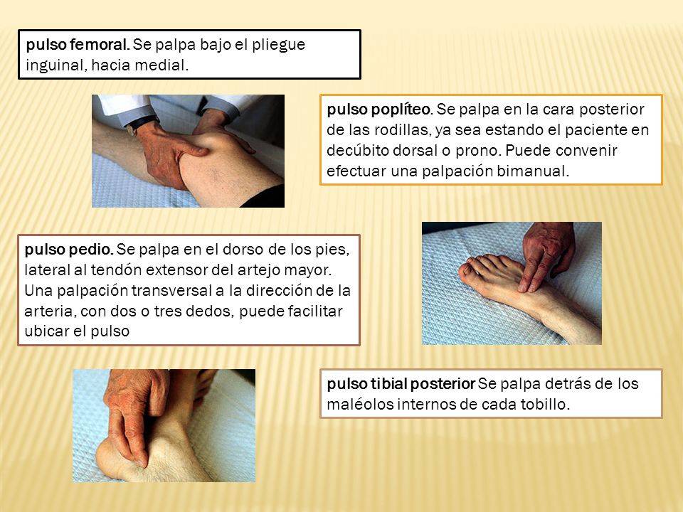 pulso femoral. Se palpa bajo el pliegue inguinal, hacia medial.