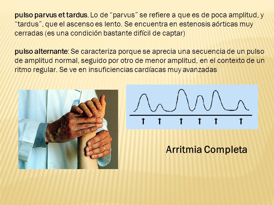pulso parvus et tardus. Lo de parvus se refiere a que es de poca amplitud, y tardus , que el ascenso es lento. Se encuentra en estenosis aórticas muy cerradas (es una condición bastante difícil de captar)