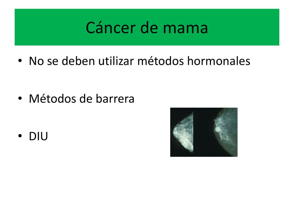 Cáncer de mama No se deben utilizar métodos hormonales
