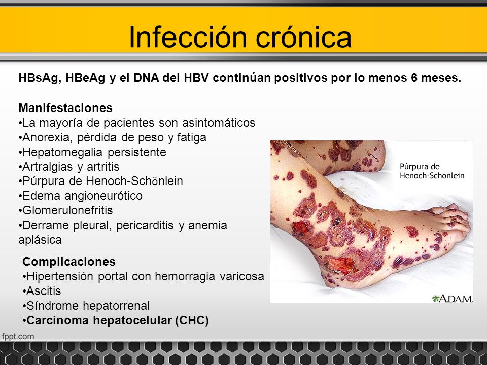Infección crónica HBsAg, HBeAg y el DNA del HBV continúan positivos por lo menos 6 meses. Manifestaciones.
