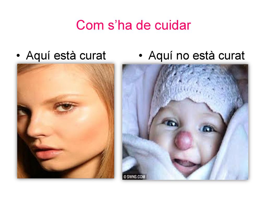 Com s’ha de cuidar Aquí està curat Aquí no està curat