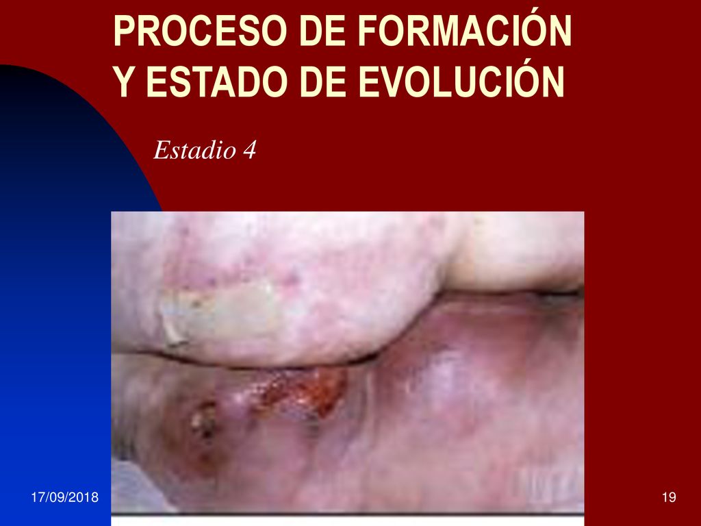 PROCESO DE FORMACIÓN Y ESTADO DE EVOLUCIÓN Estadio 4 17/09/2018